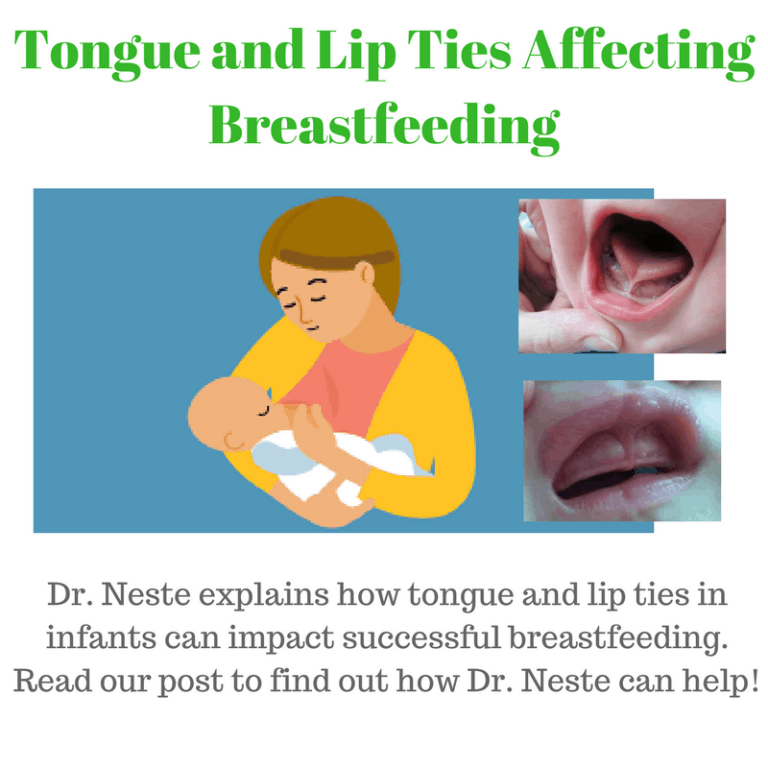 Silverdale Dental Center can solve tongue and lip ties in infants