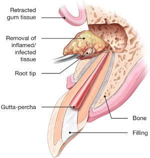 Traumatic Injuries